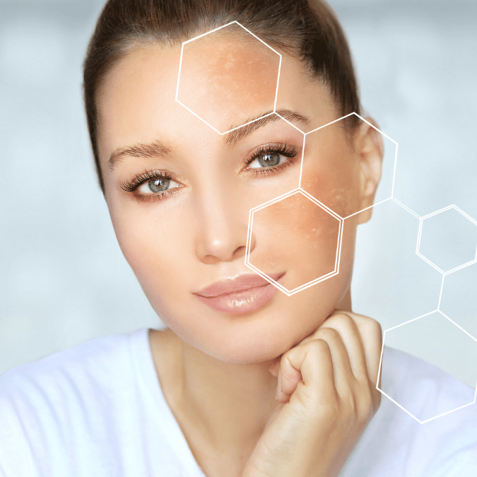 Rostro de mujer señalando las zonas donde se manifiestan los signos del envejecimiento